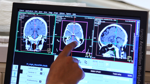 L’établissement vient d’inaugurer la nouvelle unité de neurologie destinée à prendre en charge des patients souffrant d'atteintes du système