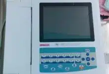 CHP Notsè : Acquisition d’un électrocardiogramme pour améliorer la prise en charge en médecine