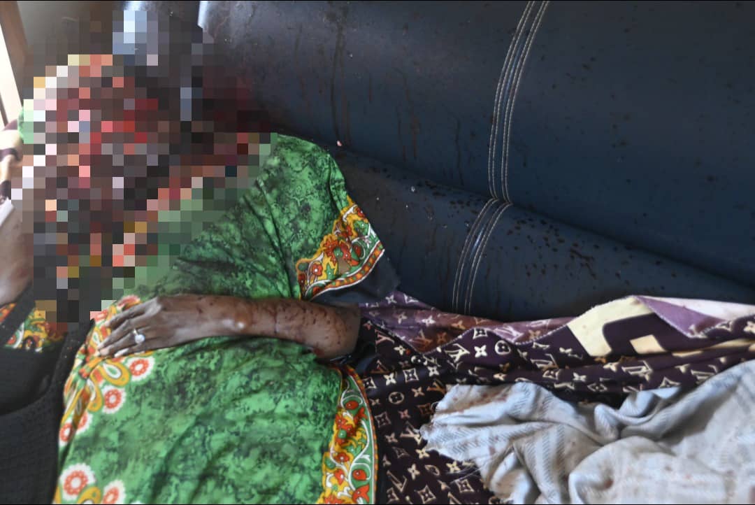 Un différend familial a tourné au drame vendredi 3 octobre 2025 à Sanguéra-Klémé. Kokouvi Mawuna, 42 ans, a mortellement agressé sa mère, Mme A. Amah, 62 ans, après une dispute portant sur des désaccords profonds liés à sa sexualité.