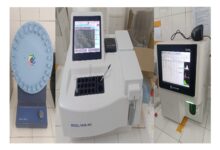 Le CHR de Kara améliore ses services avec des équipements de laboratoire de dernière génération pour des diagnostics plus précis.