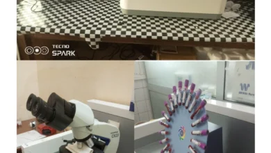 Le CHR d’Atakpamé renforce son laboratoire avec de nouveaux équipements, améliorant la qualité des soins pour la région.